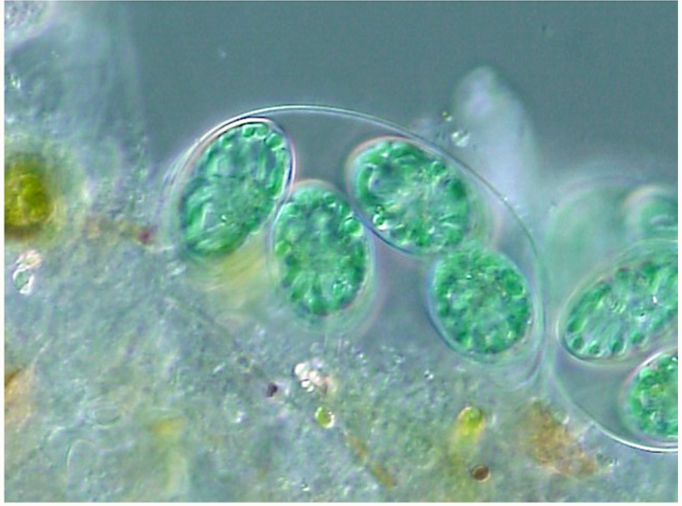 Глаукоцистофитовые водоросли обладают необычными фотосинтезирующими органеллами —… — задание 1, 11 класс